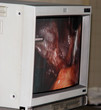 surgery