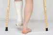 The person with plaster on a foot stands on a floor