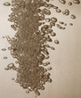 bubbles in water