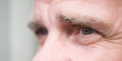 Expression of eyes