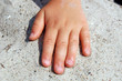 Kinderhand