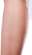 Leg