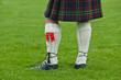 Scottish style Scottish style
