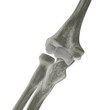 Elbow X-ray