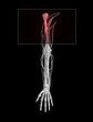 Shoulder and Muscle Pain