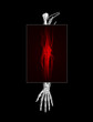 Elbow Pain