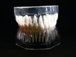 Dentalgebiss mit Wurzeln
