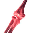 Elbow Bone Pain
