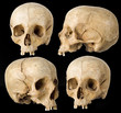 Human Skull