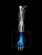 Wrist MRI