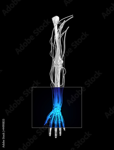 Illustration: Wrist MRI Wrist MRI