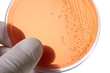 Petri dishes for medical research