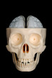 Skull with Exposed Brain