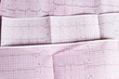 EKG / ECG
