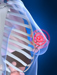 painful breast