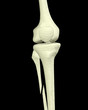 Broken Leg