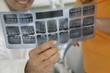 Dentist and patient examining X-rays, close-up