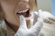 Woman having dental mold fitted, close-up