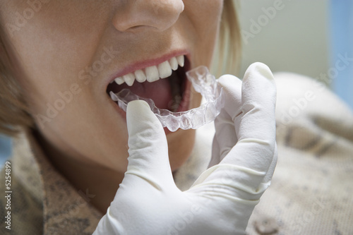 Photo: Woman having dental mold fitted, close-up Woman having dental mold fitted, close-up