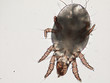 mite under microscope mite under microscope