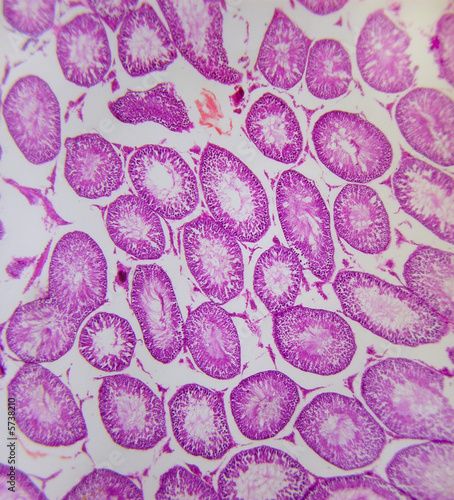A low power view of testis tissue cross section A low power view of testis tissue cross section