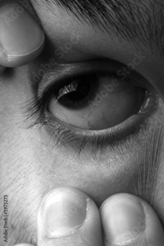 Photo: Man streaching his eye Man streaching his eye