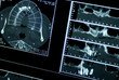 Tomography of mouth