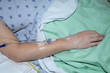 Patient with IV tubes