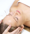 Photo: Acupuncture therapy - alternative medicine Acupuncture therapy - alternative medicine