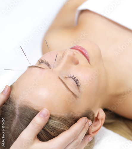 Acupuncture therapy - alternative medicine