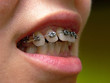 Teeth