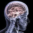 Skeleton X-Ray - Brain 1 Skeleton X-Ray - Brain 1