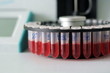 test of blood