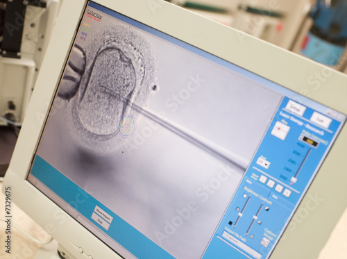 Photo: Monitor showing intra cytoplasmic sperm injection Monitor showing intra cytoplasmic sperm injection
