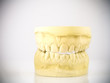 model of denture