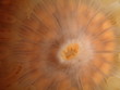 anemone mouth