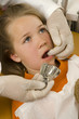 Dentist examining a girl's teeth