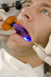 Close-up of a young man getting his teeth examined