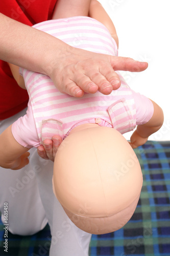 Photo: Infant suffocation rescue technique Infant suffocation rescue technique