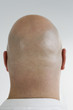 Rear view of a bald headed man.
