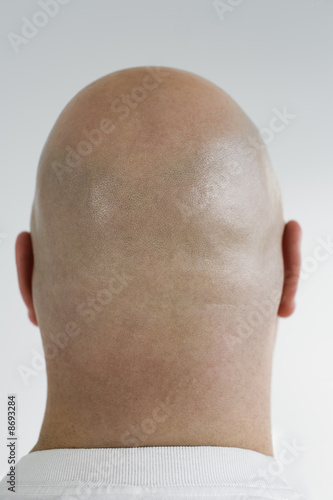 Foto: Rear view of a bald headed man. Rear view of a bald headed man.