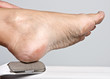 Hand removing callous from a dry foot