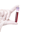 hand holding blood in test tube close up