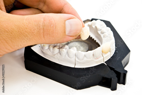 Photo: plaster dental mold with hand and sample tooth plaster dental mold with hand and sample tooth
