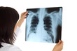 Female doctor looking at x-ray image on white