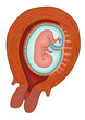 Uterus with fetus at 8 weeks gestation