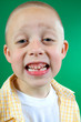 Teethe Smile with missing tooth Teethe Smile with missing tooth