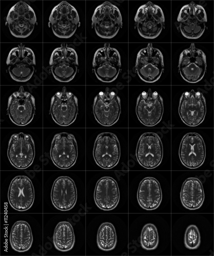 IRM du cerveau - Série 2