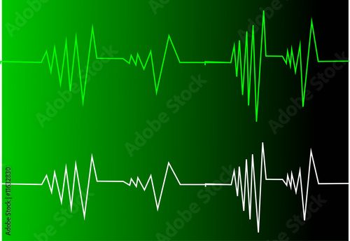 Illustration: wave form equalizer 1 wave form equalizer 1