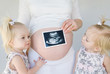 Twins with New Baby on the Way Twins with New Baby on the Way